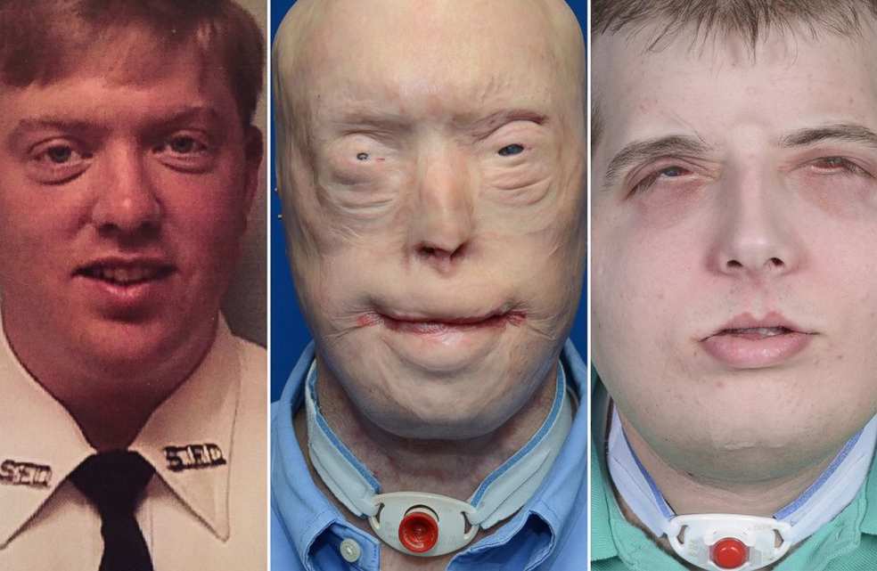 Jokkere yeeso no woorunoo